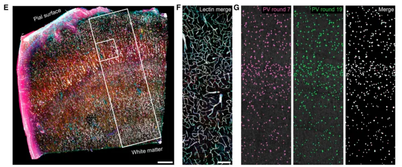 (E) Fully co-registered image showing an overlay of 9 rounds of immunostaining. A total of 22 rounds of staining of the same tissue was achieved. R#2 (Iba1), R#3 (GFAP), R#4 (calbindin, CB), R#5 (calretinin, CR), R#7 (PV), R#8 (Neuropeptide Y), R#9 (NeuN), R#18 (SMI-32), and R#19 (PV) were used for co-registration and subsequent quantitative analysis (see Figure 3). The boxed regions indicate the ROI’s shown in panels. (F–G) Scale bar, 300 mm. (F) Vasculature labeling from 9 rounds of staining after co-regi