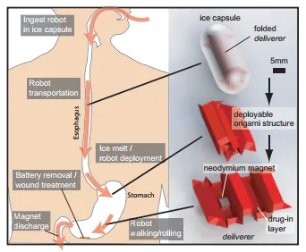 Fig. 1. The developed system. An iced robot is transported into an artificial stomach. Once the ice melts and the robot is deployed, the robot is controlled using a remote magnetic field. The robot removes a foreign body, such as a button battery, from the location and further treats an inflammation by delivering a drug.